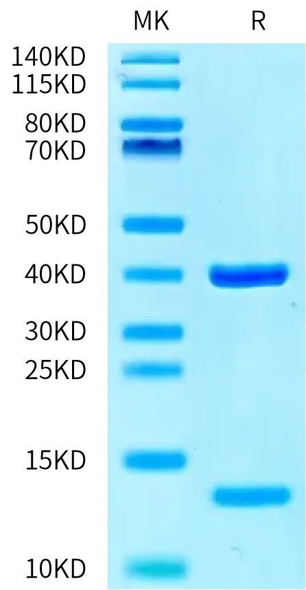 PRAME-HP004 Bis-Tris-PAGE-white result