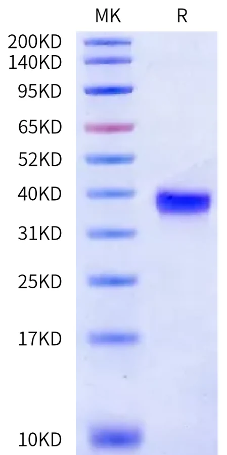 PRLR-HB001 Bis-Tris-PAGE-white result