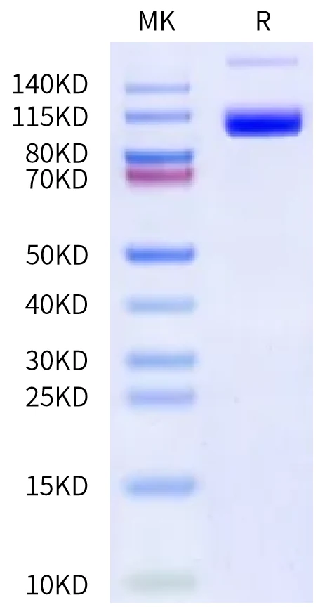 PSMA-HP001 Bis-Tris-PAGE-white result