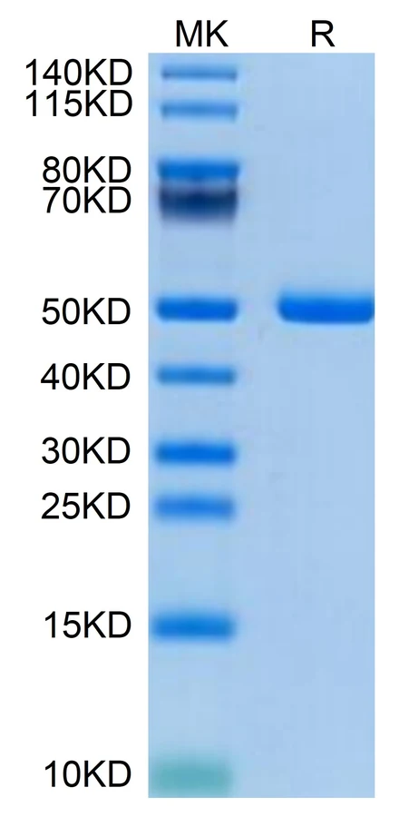 PSMP-MF001 Bis-Tris-PAGE result