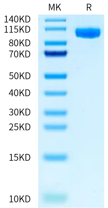 PTK7-MB001 Bis-Tris-PAGE-white result
