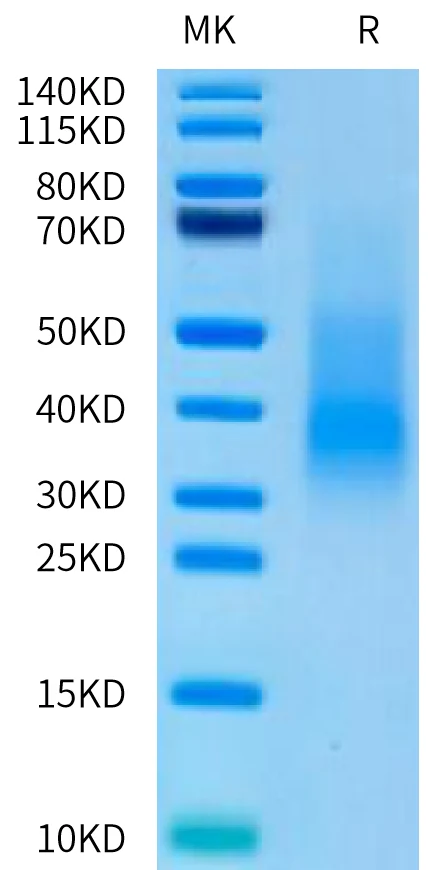 RANKL-HP001 Bis-Tris-PAGE-white result