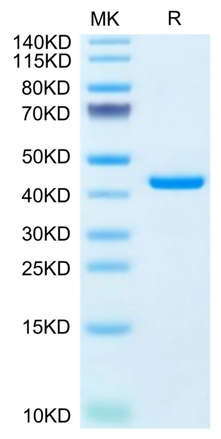 RETN-HF001 Bis-Tris-PAGE-white result