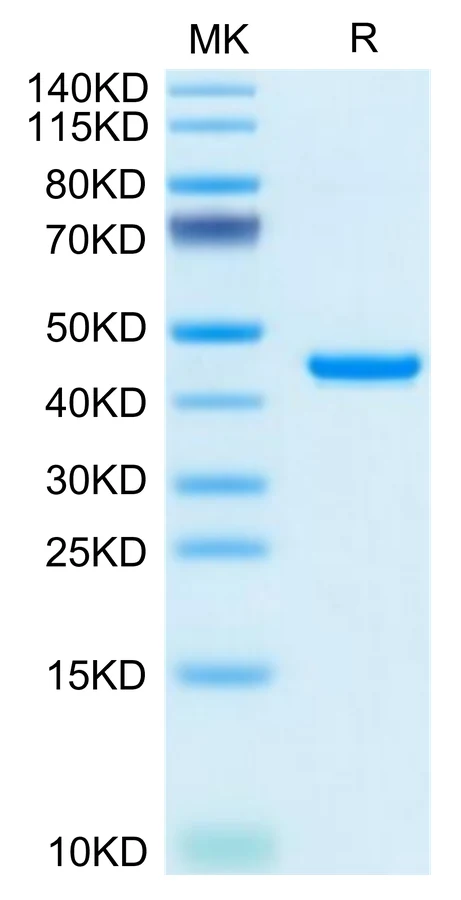 RETN-MF001 Bis-Tris-PAGE-white result