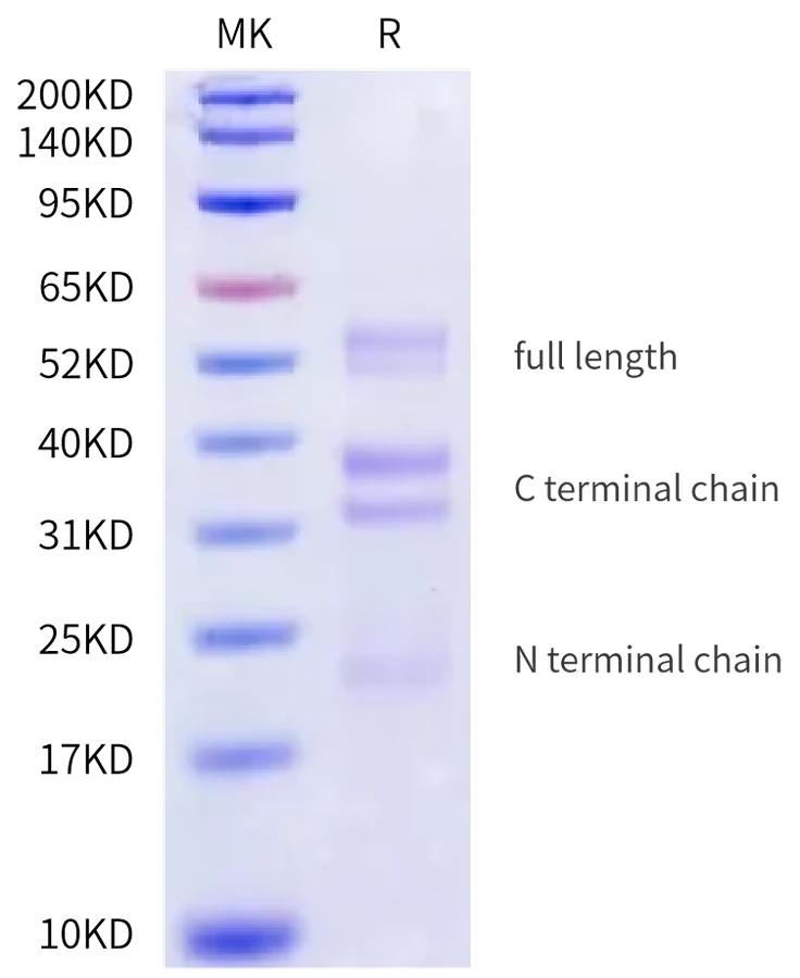 RGMC-HB001 Bis-Tris-PAGE-white result