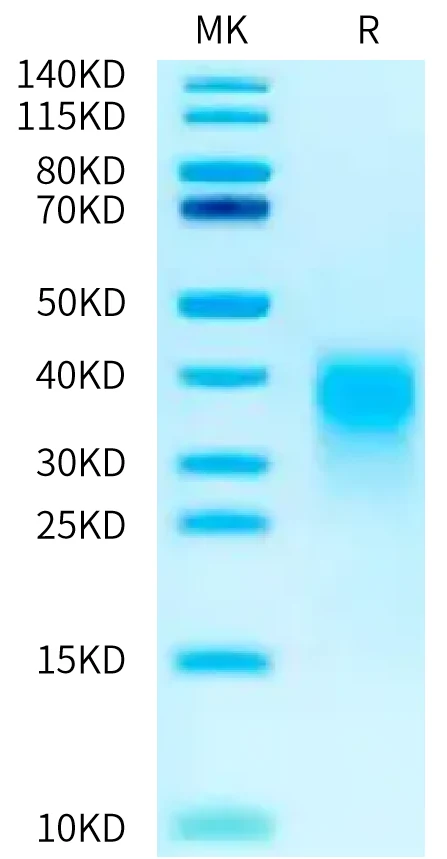 RIIB-HB001 Bis-Tris-PAGE-white result