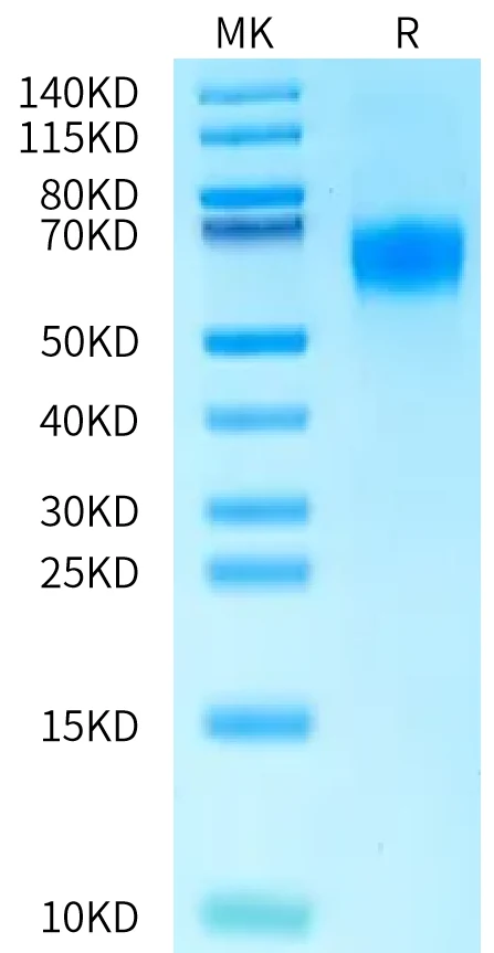 RIIB-HF001 Bis-Tris-PAGE-white result