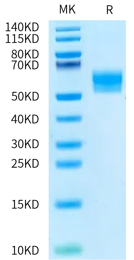 RIIB-HF003 Bis-Tris-PAGE-white result