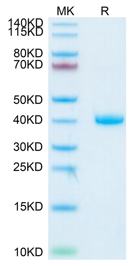 RSPONDIN1-HP001 Bis-Tris-PAGE result