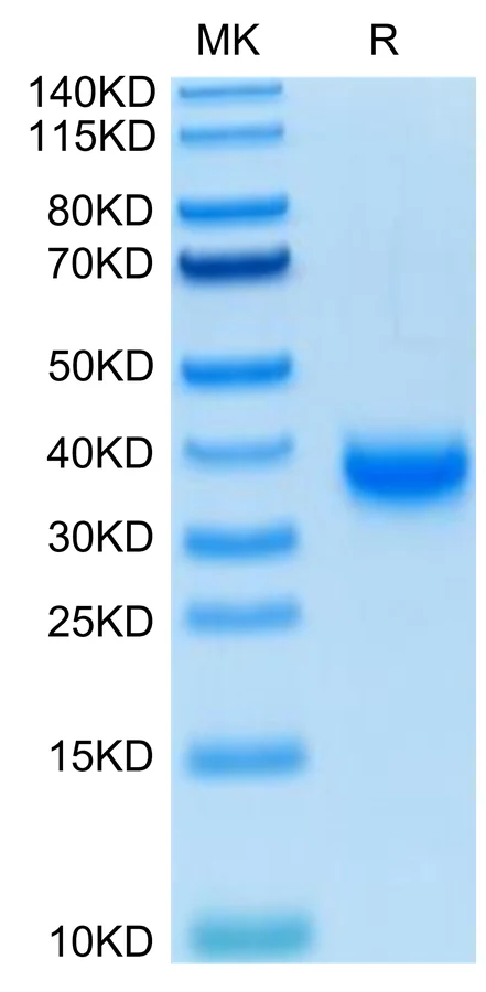 SARS-HB002 Bis-Tris-PAGE-white result