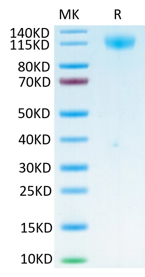 SARS-HB004 Bis-Tris-PAGE-white result