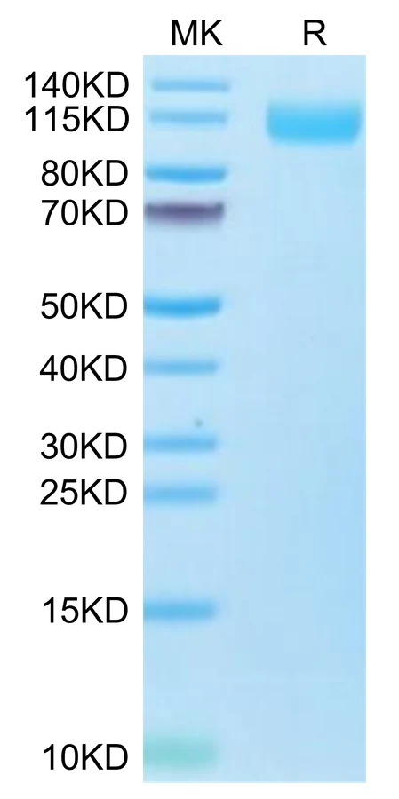 SARS-HB005 Bis-Tris-PAGE-white result
