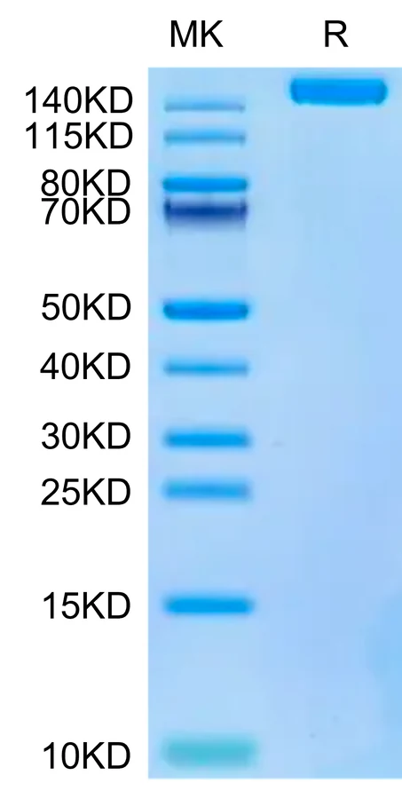 SARS-HB006 Bis-Tris-PAGE-white result