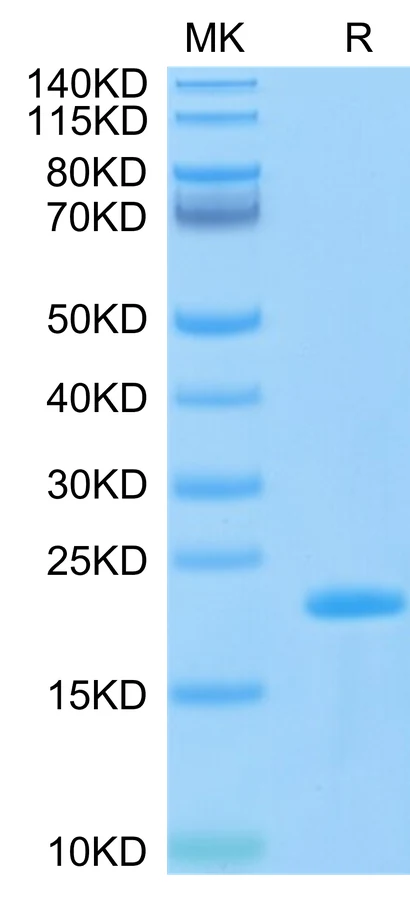 SARS-HB009 Bis-Tris-PAGE-white result