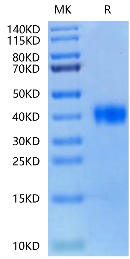 SARS-HB011 Bis-Tris-PAGE-white result