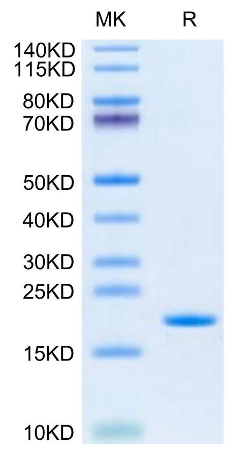 SCF-HP001 Bis-Tris-PAGE-white result