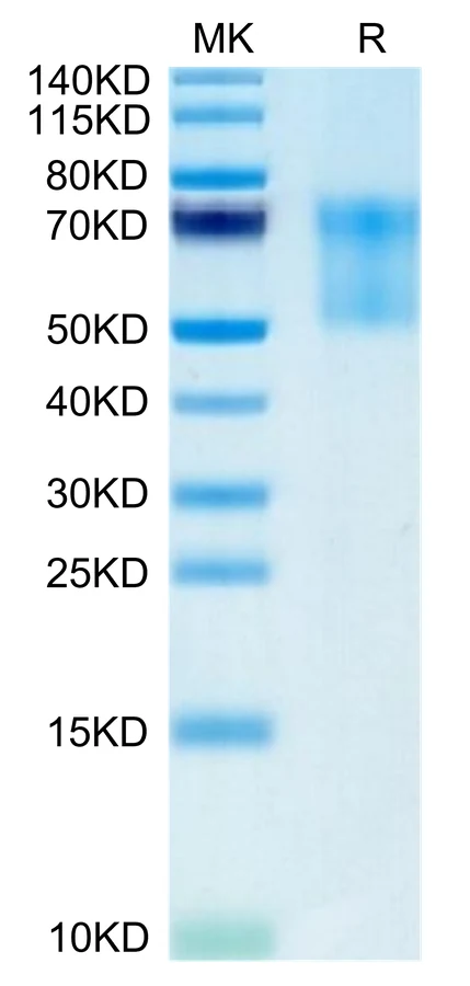SDC1-HB001 Bis-Tris-PAGE-white result