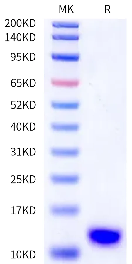 SEZ6-HB002 Bis-Tris-PAGE-white result
