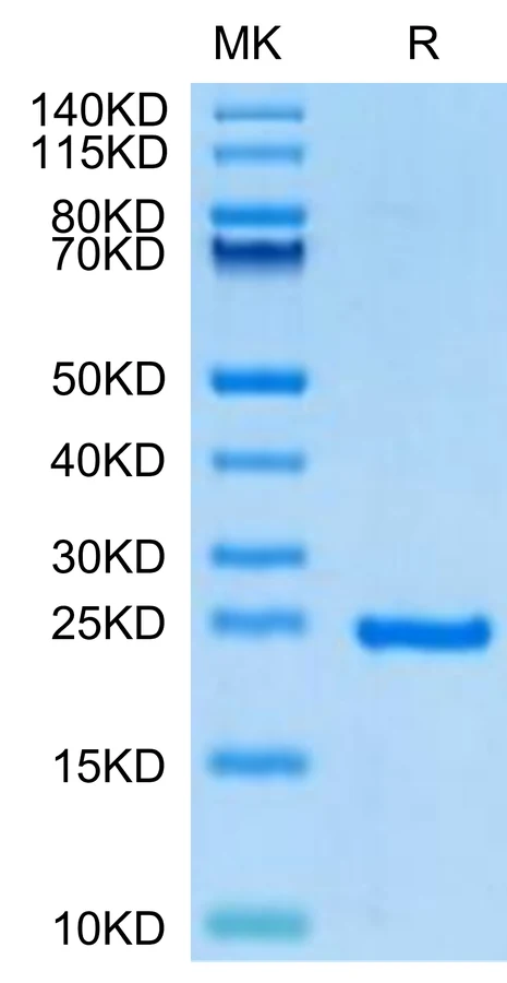 SHH-HP001 Bis-Tris-PAGE-white result