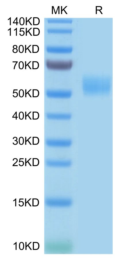 SIRPB-HB001 Bis-Tris-PAGE-white result