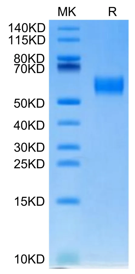 SIRPB-HB002 Bis-Tris-PAGE-white result