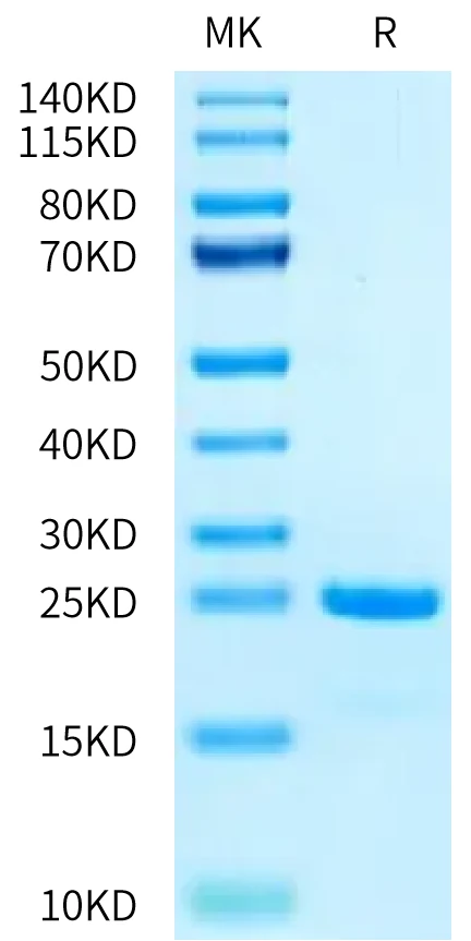 SKP1-HB001 Bis-Tris-PAGE-white result