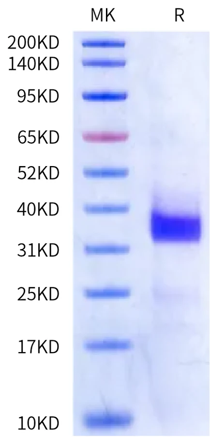 SOST-CB001 Bis-Tris-PAGE-white result