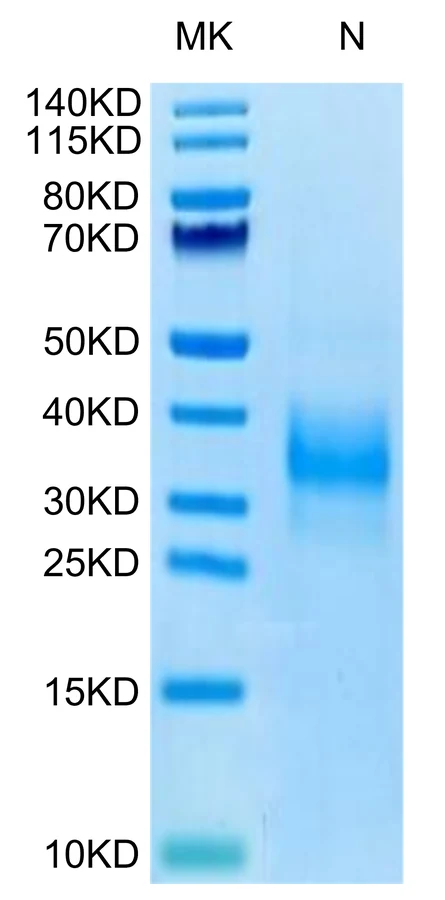 SOST-HB002 Bis-Tris-PAGE-white result