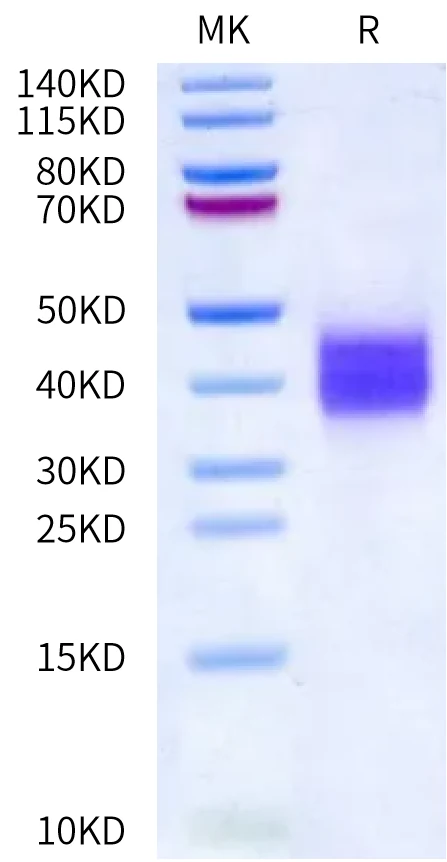 SOST-MB001 Bis-Tris-PAGE-white result