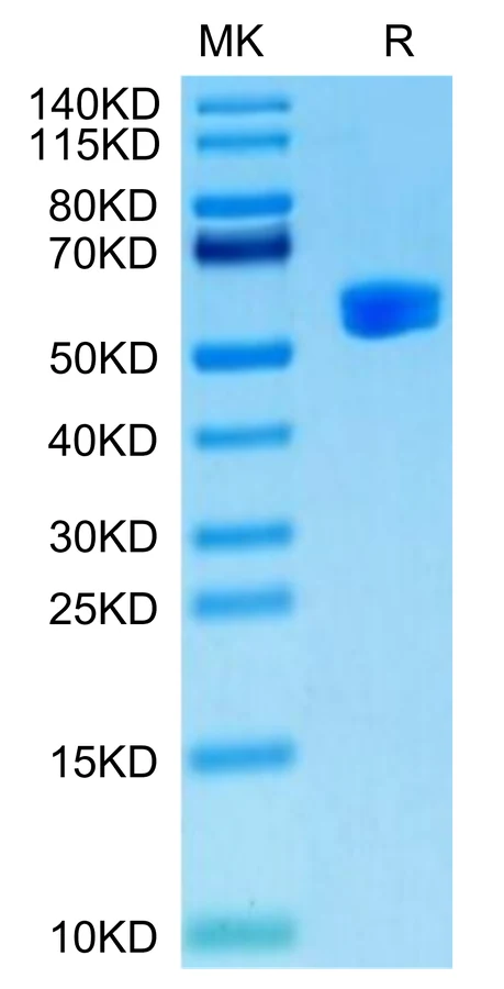 SURVIVIN2B-HP001 Bis-Tris-PAGE-white result
