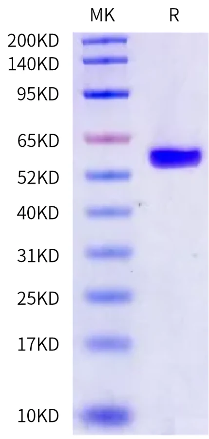 TDT-HB002 Bis-Tris-PAGE-white result