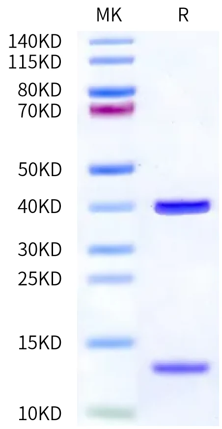 TERT-HB002 Bis-Tris-PAGE-white result