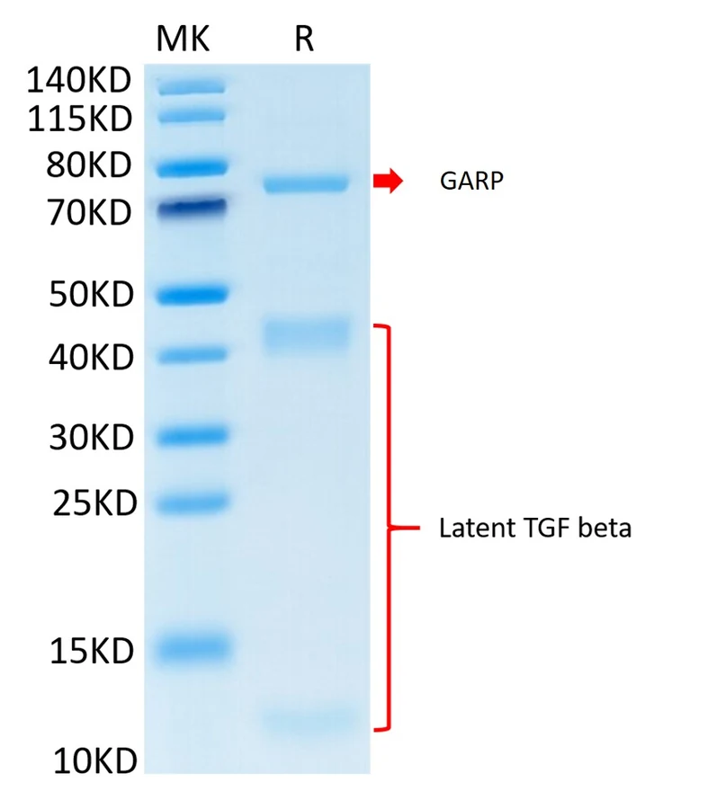TGFB1-CP001 Bis-Tris-PAGE result