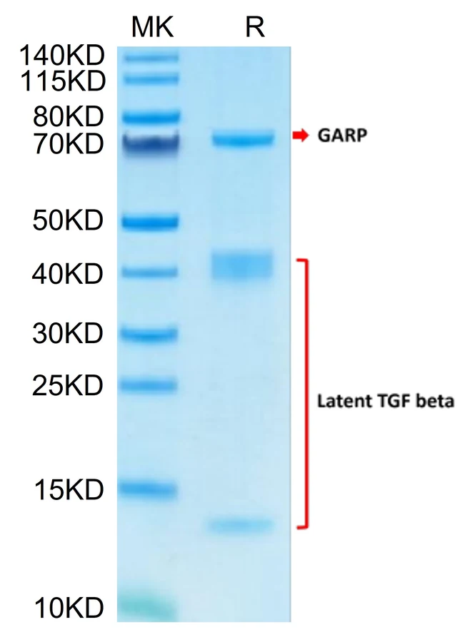 TGFB1-HP002 Bis-Tris-PAGE result