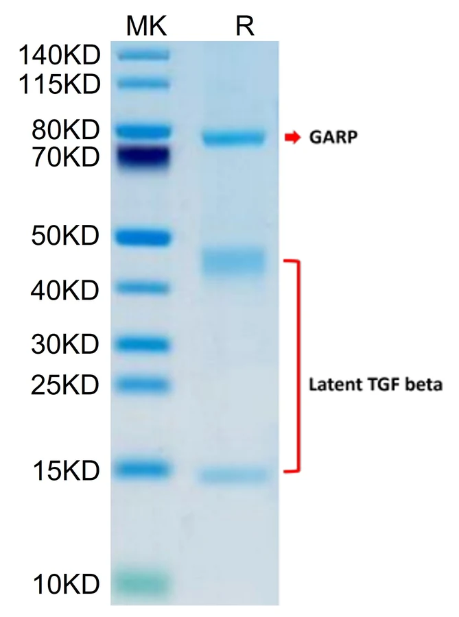 TGFB1-HP003 Bis-Tris-PAGE result
