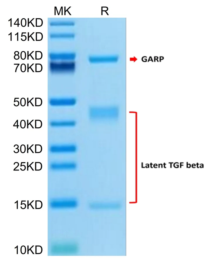 TGFB1-HP004 Bis-Tris-PAGE result