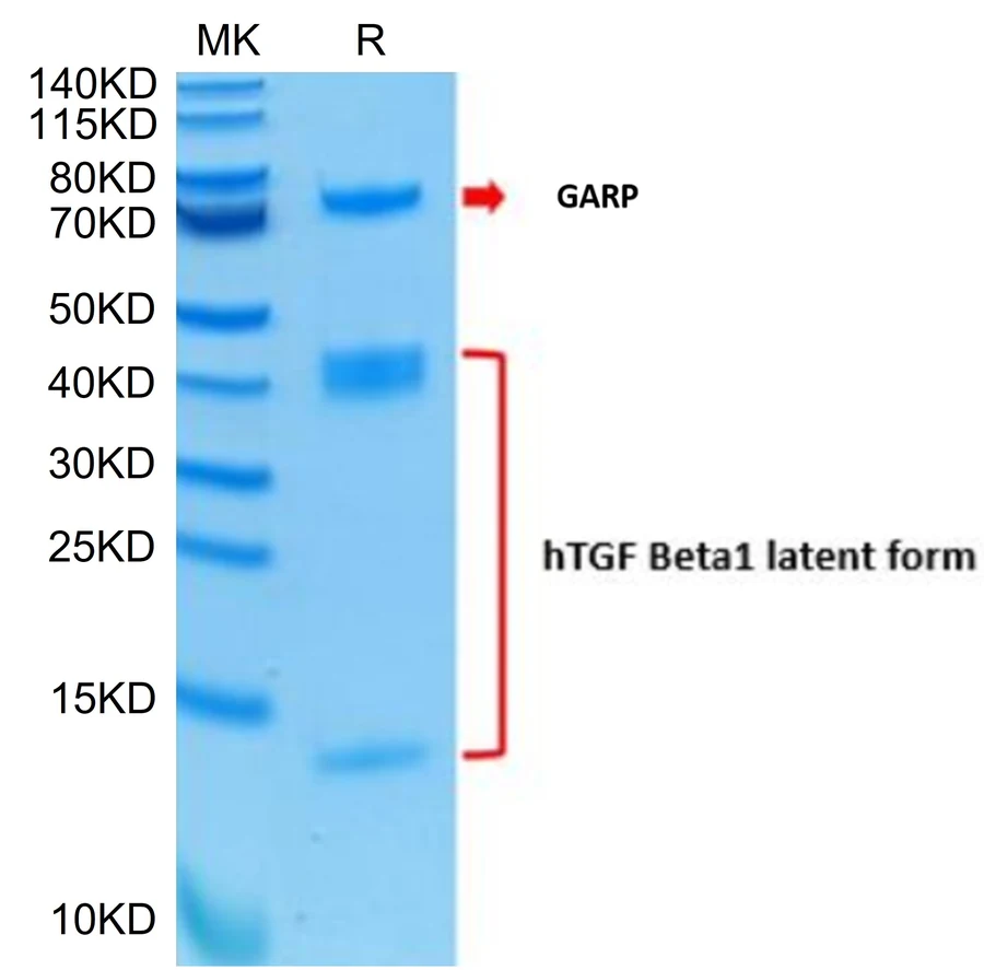 TGFB1-HP005 Bis-Tris-PAGE result