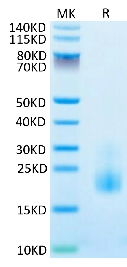 TIGIT-CP001 Bis-Tris-PAGE-white result
