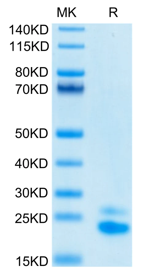 TNFRSF10B-HB001 Bis-Tris-PAGE-white result
