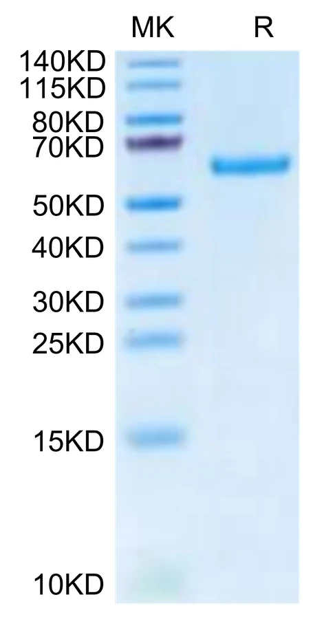 TNFRSF11A-MF001 Bis-Tris-PAGE-white result