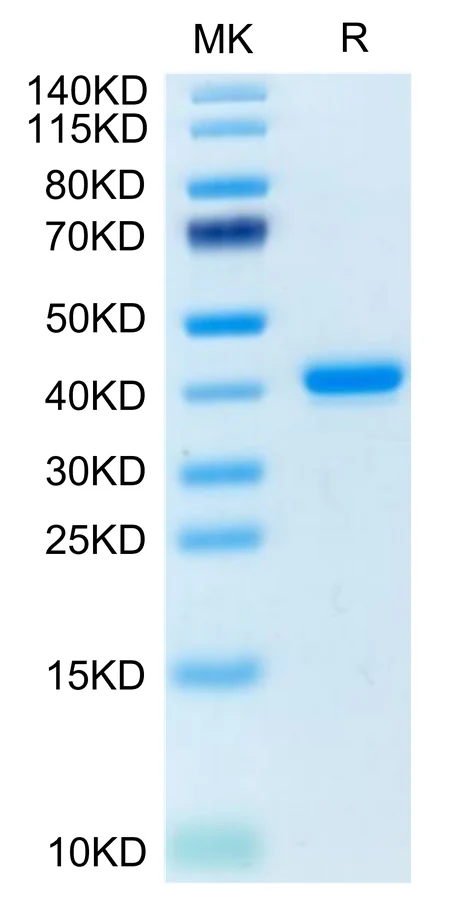 TNFRSF12A-HF001 Bis-Tris-PAGE-white result