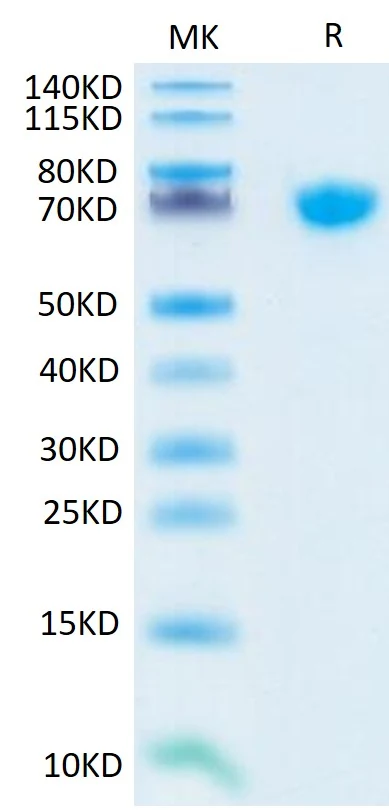 TNFSF15-HP003 Bis-Tris-PAGE result