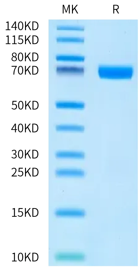 TNFSF15-HP004 Bis-Tris-PAGE-white result