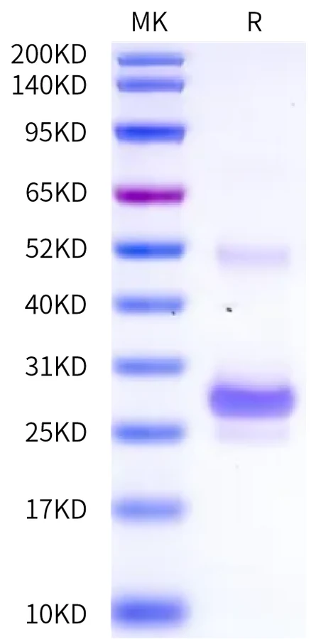 TNFSF15-JP001 Bis-Tris-PAGE-white result