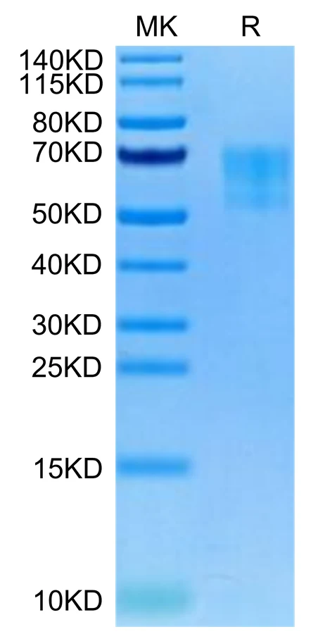 TPBG-HB001 Bis-Tris-PAGE-white result