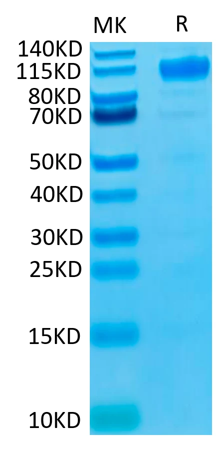 VEGFR1-HB001 Bis-Tris-PAGE-white result