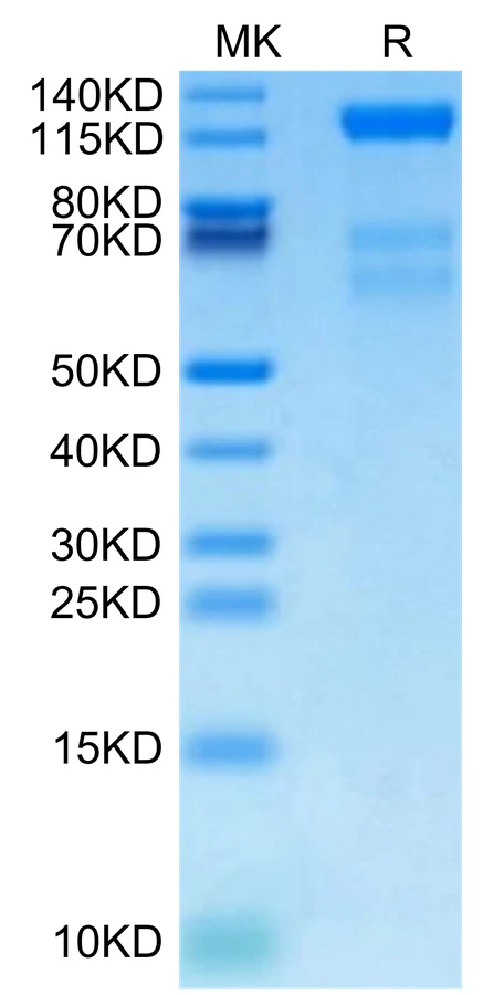 VEGFR3-HB001 Bis-Tris-PAGE-white result