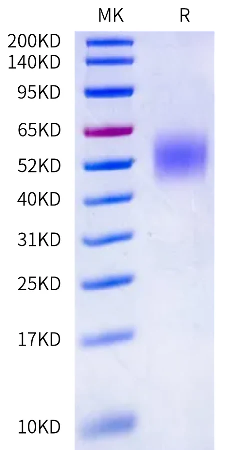 VISTA-CB001 Bis-Tris-PAGE-white result