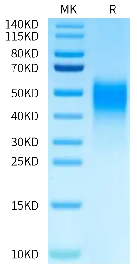 VISTA-HB001 Bis-Tris-PAGE-white result