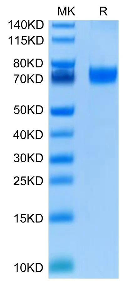 VISTA-HF001 Bis-Tris-PAGE-white result